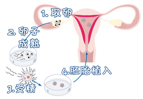 林靜遠